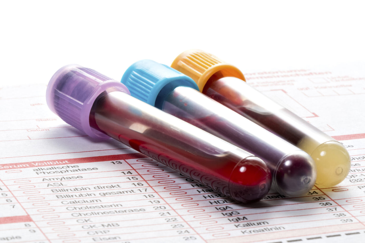 Comprehensive Blood Analysis